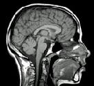 Cerveau-scan-copie-1.jpg