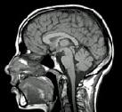 Cerveau-scan.jpg
