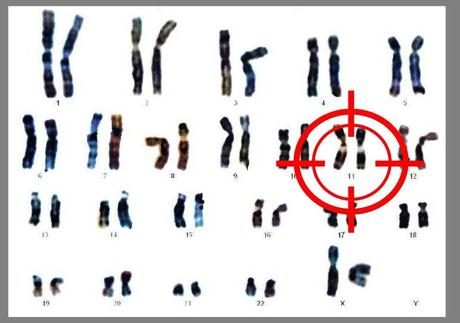 Caryotype d'une petite fille, avant naissance - National Human Genome Research Institute